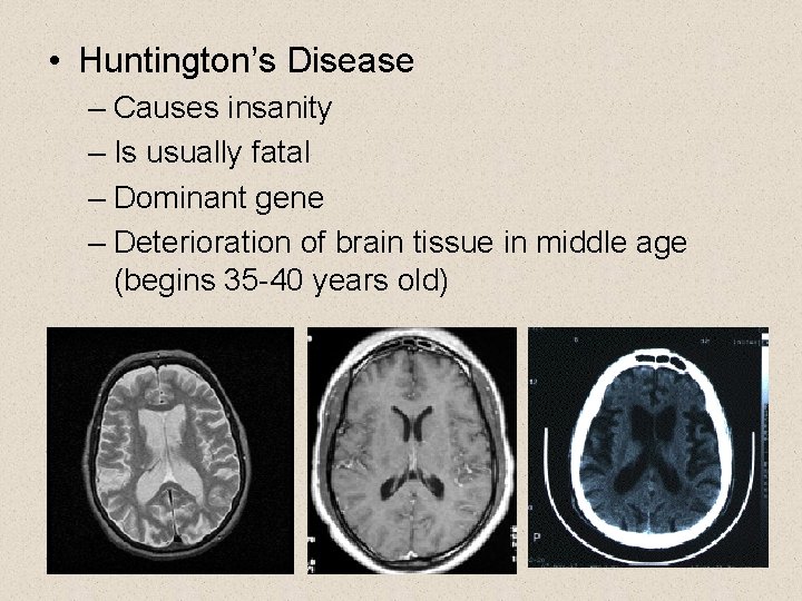  • Huntington’s Disease – Causes insanity – Is usually fatal – Dominant gene