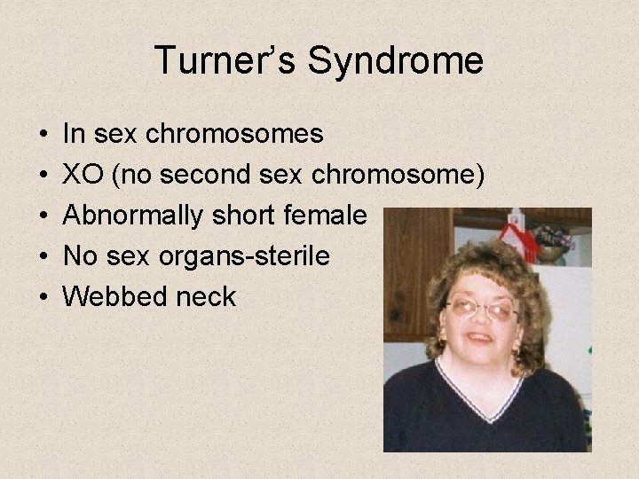 Turner’s Syndrome • • • In sex chromosomes XO (no second sex chromosome) Abnormally