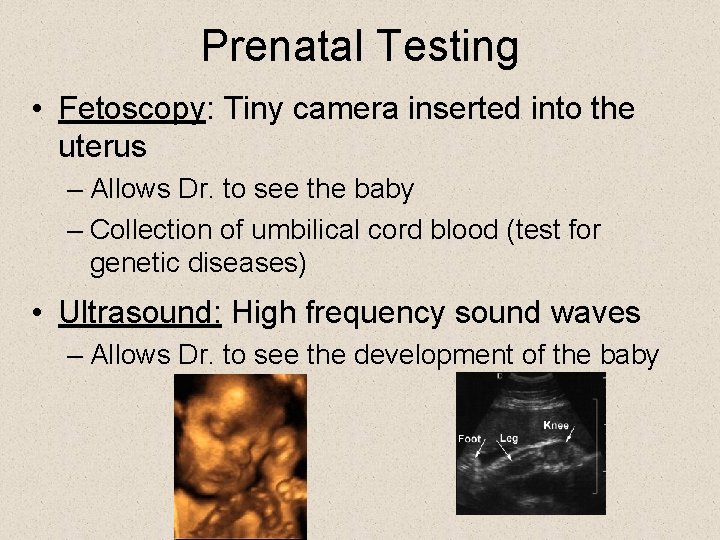 Prenatal Testing • Fetoscopy: Tiny camera inserted into the uterus – Allows Dr. to