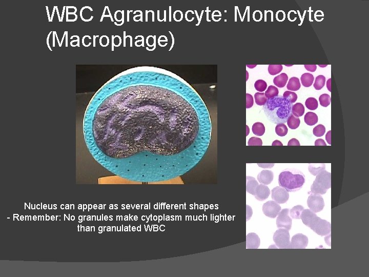 WBC Agranulocyte: Monocyte (Macrophage) Nucleus can appear as several different shapes - Remember: No