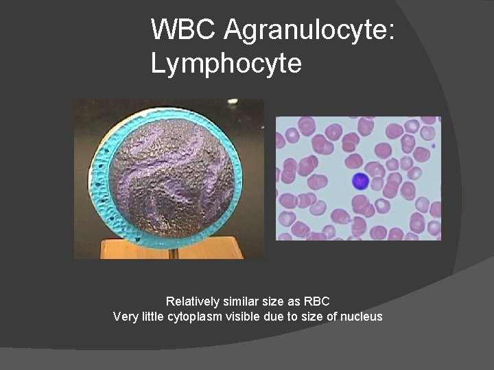 WBC Agranulocyte: Lymphocyte Relatively similar size as RBC Very little cytoplasm visible due to