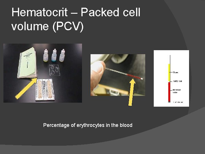 Hematocrit – Packed cell volume (PCV) Percentage of erythrocytes in the blood 