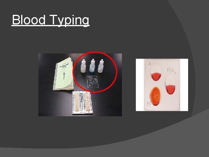 Blood Typing Blood Typing
