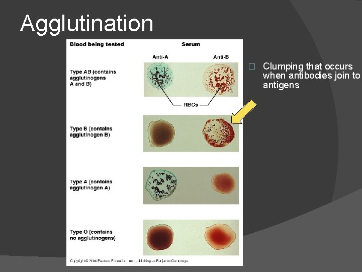 Agglutination � Clumping that occurs when antibodies join to antigens 