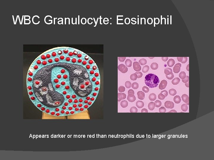 WBC Granulocyte: Eosinophil Appears darker or more red than neutrophils due to larger granules