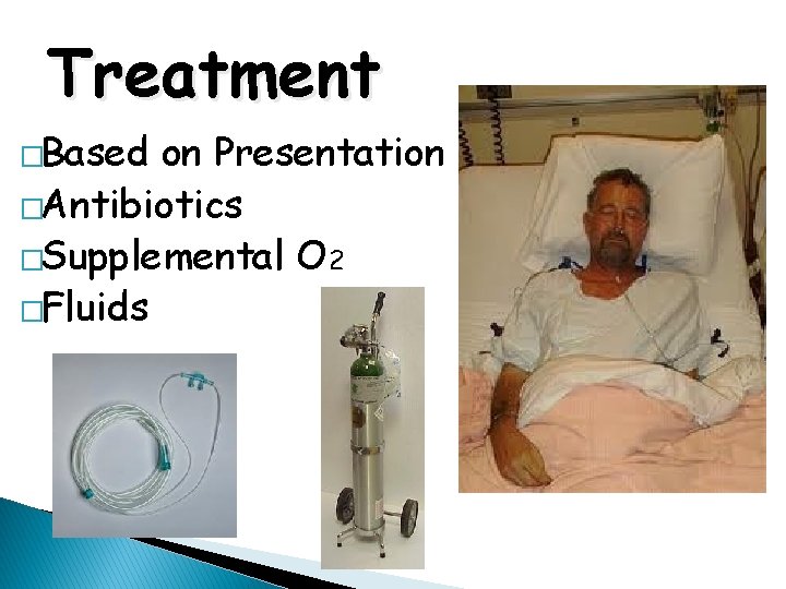 Treatment �Based on Presentation �Antibiotics �Supplemental O 2 �Fluids 