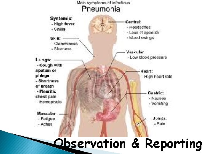 Observation & Reporting 