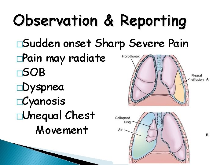 Observation & Reporting �Sudden onset Sharp Severe Pain �Pain may radiate �SOB �Dyspnea �Cyanosis