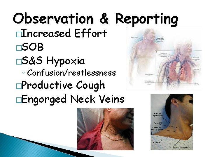 Observation & Reporting �Increased �SOB �S&S Effort Hypoxia ◦ Confusion/restlessness �Productive Cough �Engorged Neck