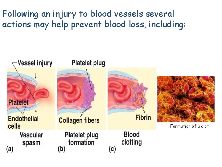 Following an injury to blood vessels several actions may help prevent blood loss, including: