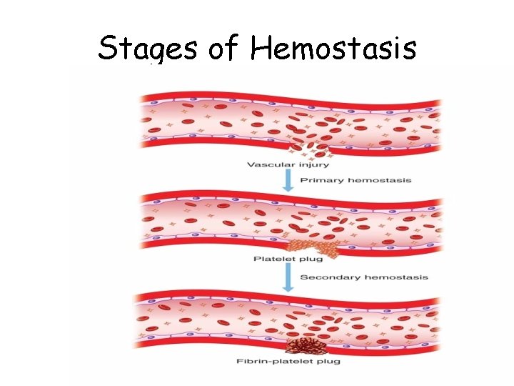 Stages of Hemostasis 