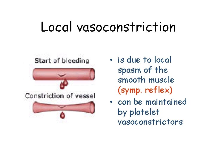 Local vasoconstriction • is due to local spasm of the smooth muscle (symp. reflex)