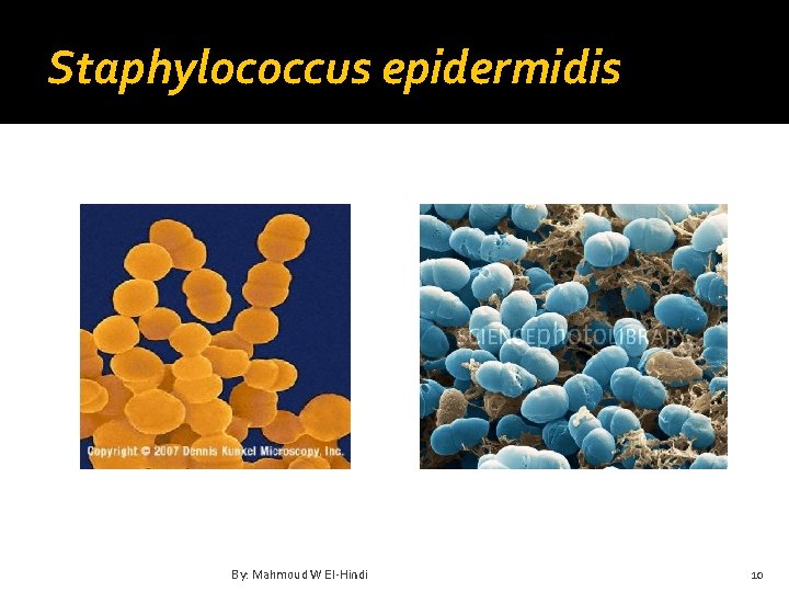 Staphylococcus epidermidis By: Mahmoud W El-Hindi 10 