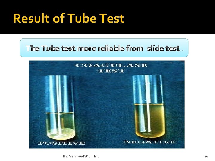 Result of Tube Test The Tube test more reliable from slide test. By: Mahmoud