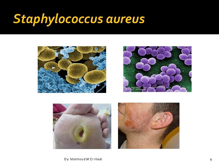 Staphylococcus aureus By: Mahmoud W El-Hindi 9 
