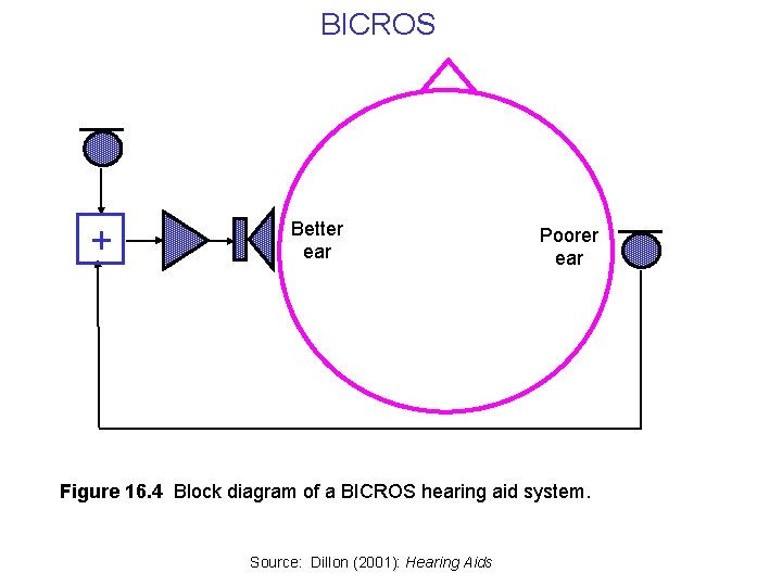 BICROS + Better ear Poorer ear Figure 16. 4 Block diagram of a BICROS