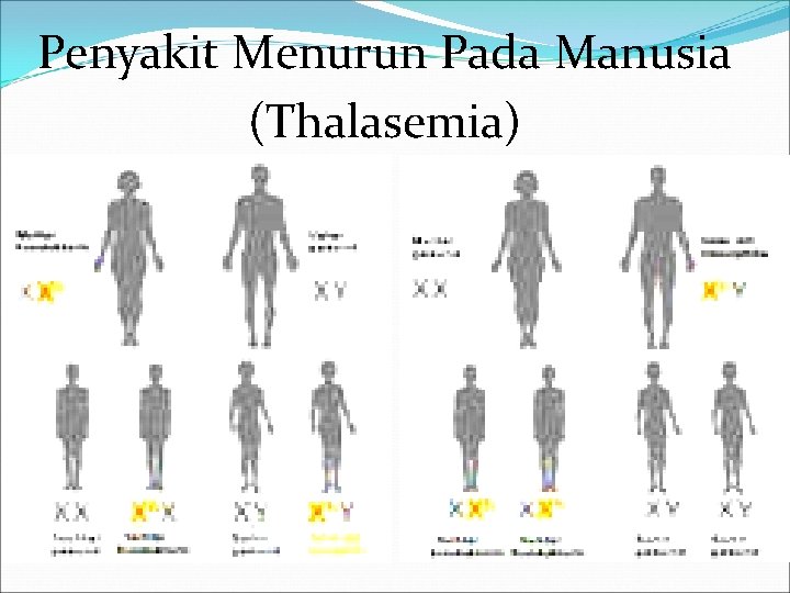 Penyakit Menurun Pada Manusia (Thalasemia) 