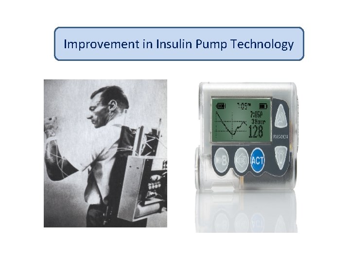 Improvement in Insulin Pump Technology 