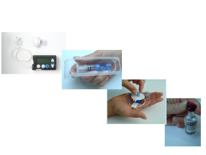 Reservoir Insulin Pump Insulin Infusion Set 
