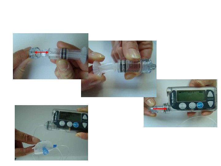 Remove Plunger Connect to Infusion Set Connect to Pump Ready to -prime 