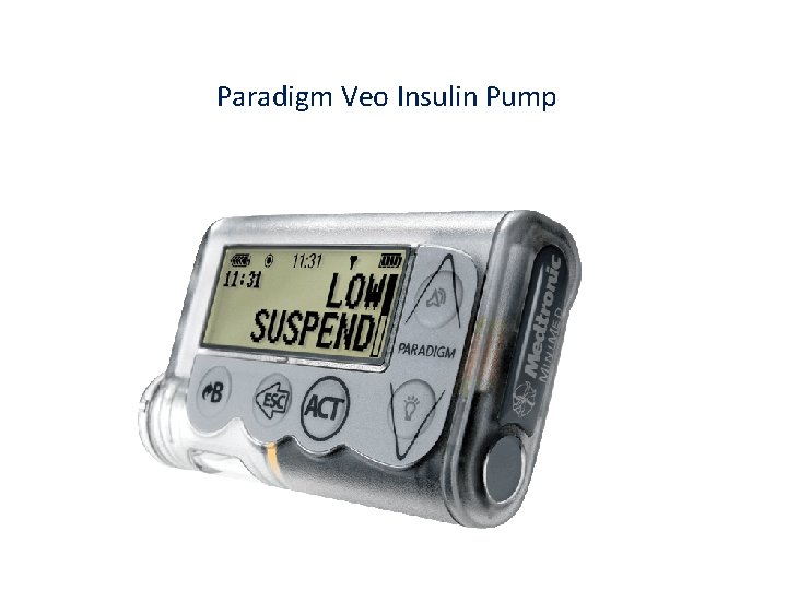 Paradigm Veo Insulin Pump 