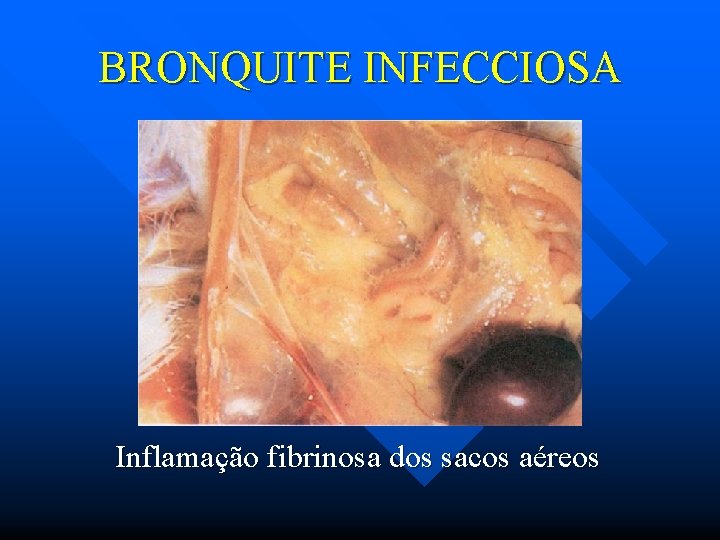 BRONQUITE INFECCIOSA Inflamação fibrinosa dos sacos aéreos 