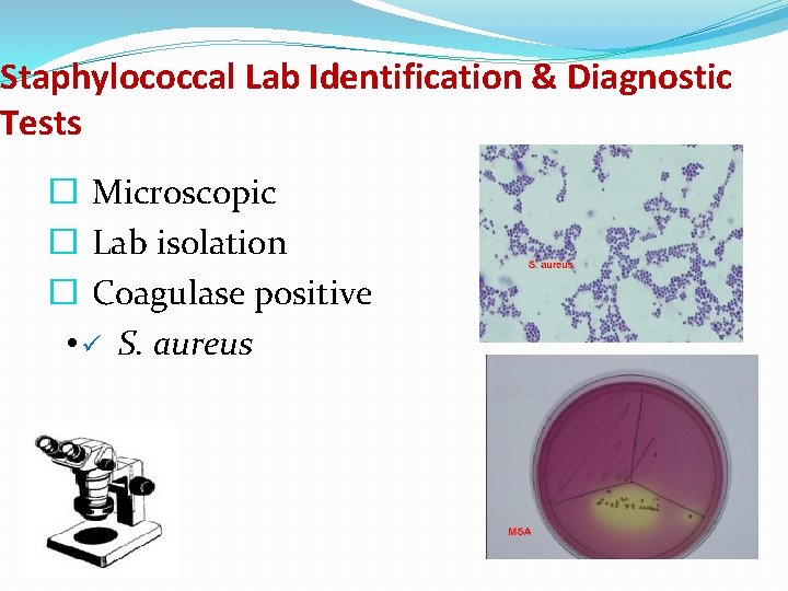 Staphylococcal Lab Identification & Diagnostic Tests � Microscopic � Lab isolation � Coagulase positive