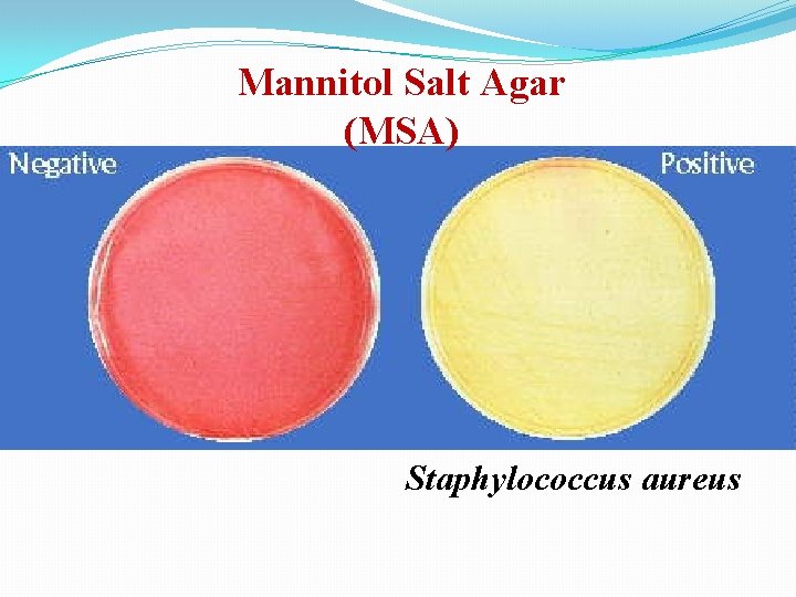 Mannitol Salt Agar (MSA) Staphylococcus aureus 