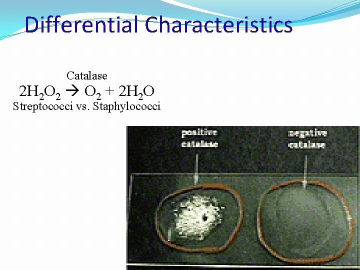 Differential Characteristics Catalase 2 H 2 O 2 + 2 H 2 O Streptococci