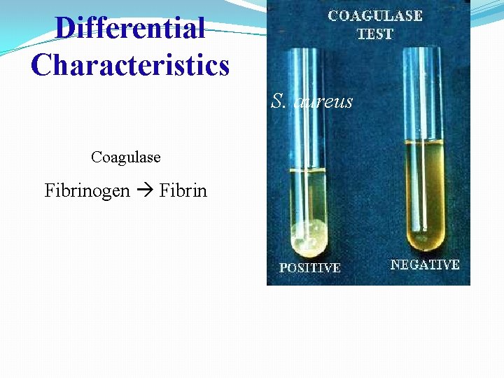 Differential Characteristics S. aureus Coagulase Fibrinogen Fibrin 