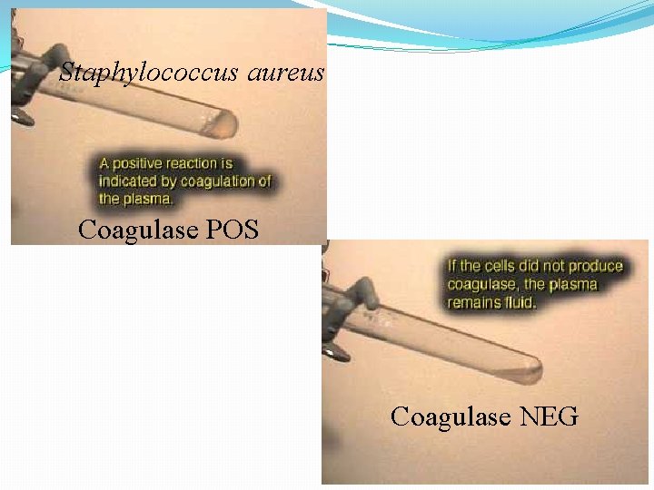 Staphylococcus aureus Coagulase POS Coagulase NEG 