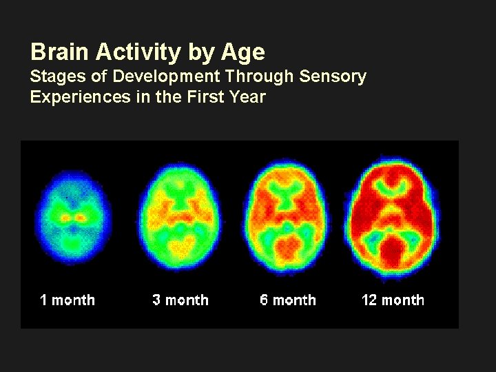 Brain Activity by Age Stages of Development Through Sensory Experiences in the First Year