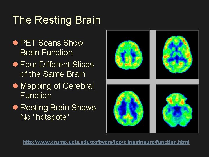 The Resting Brain l PET Scans Show Brain Function l Four Different Slices of