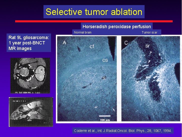 Selective tumor ablation Horseradish peroxidase perfusion Normal brain Tumor scar Rat 9 L gliosarcoma: