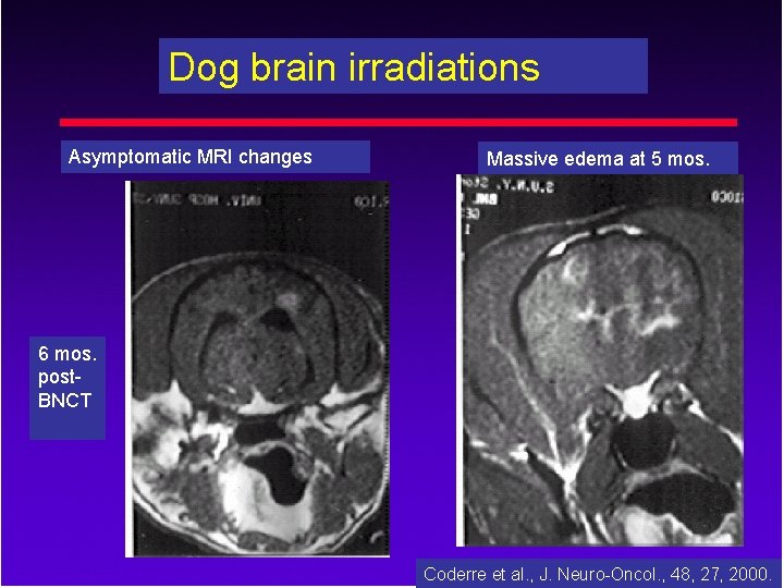 Dog brain irradiations Asymptomatic MRI changes Massive edema at 5 mos. 6 mos. post.