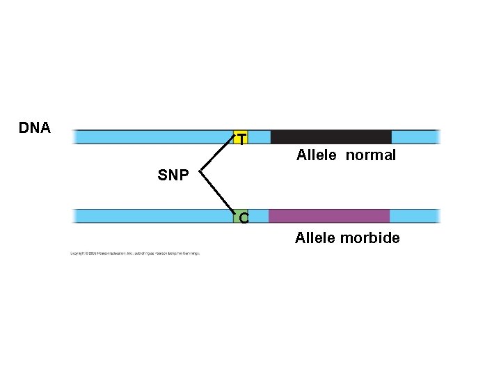 DNA T Allele normal SNP C Allele morbide 