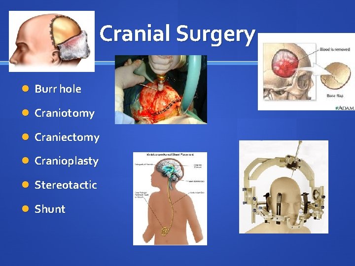 Cranial Surgery Burr hole Craniotomy Craniectomy Cranioplasty Stereotactic Shunt 