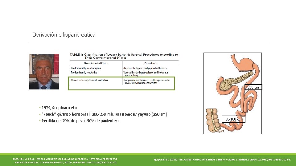 Derivación biliopancreática 250 cm • 1979, Scopinaro et al. • “Pouch” gástrico horizontal (200