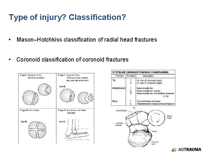 Type of injury? Classification? • Mason–Hotchkiss classification of radial head fractures • Coronoid classification