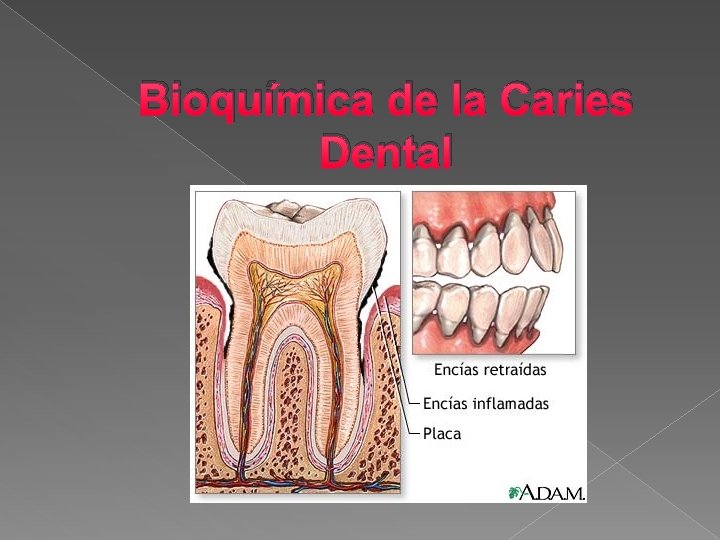 Bioquímica de la Caries Dental 