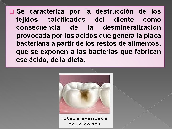 � Se caracteriza por la destrucción de los tejidos calcificados del diente como consecuencia