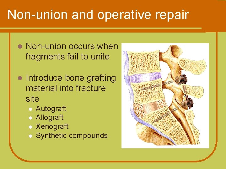 Non-union and operative repair l Non-union occurs when fragments fail to unite l Introduce