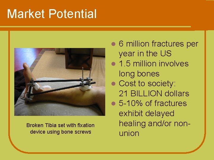 Market Potential 6 million fractures per year in the US l 1. 5 million