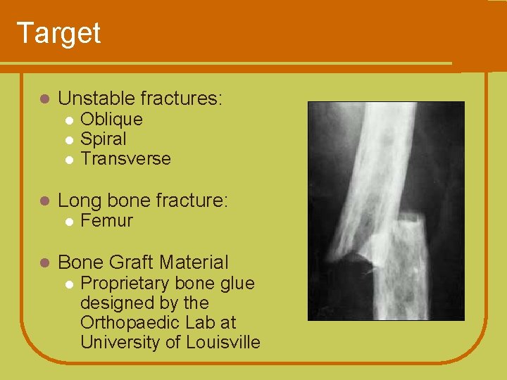 Target l Unstable fractures: l l Long bone fracture: l l Oblique Spiral Transverse