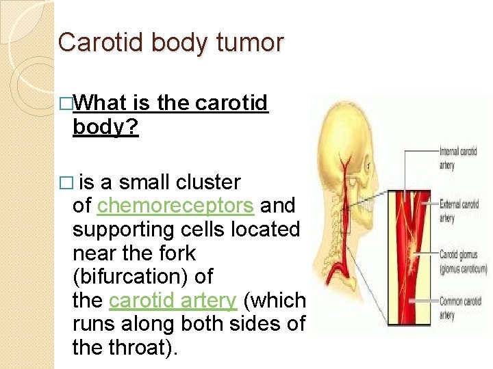 Carotid body tumor �What is the carotid body? � is a small cluster of