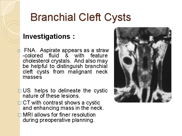 Branchial Cleft Cysts Investigations : � FNA. Aspirate appears as a straw -colored fluid