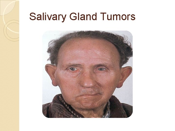 Salivary Gland Tumors 