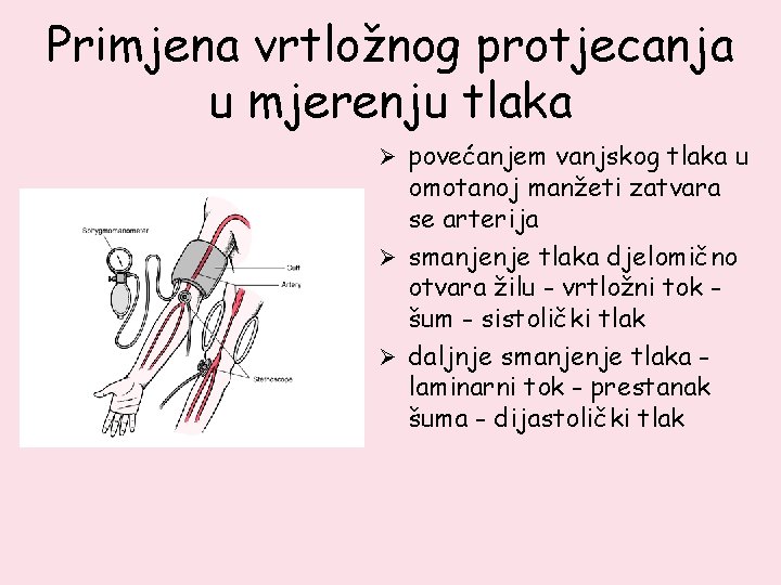 Primjena vrtložnog protjecanja u mjerenju tlaka Ø povećanjem vanjskog tlaka u omotanoj manžeti zatvara