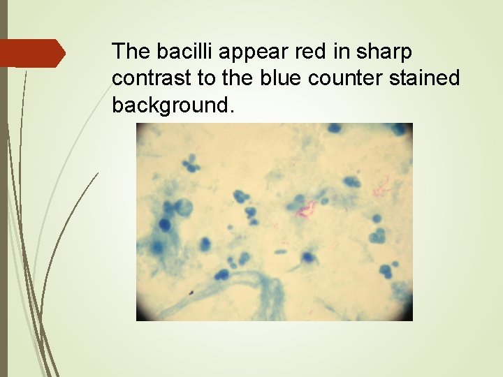 The bacilli appear red in sharp contrast to the blue counter stained background. 