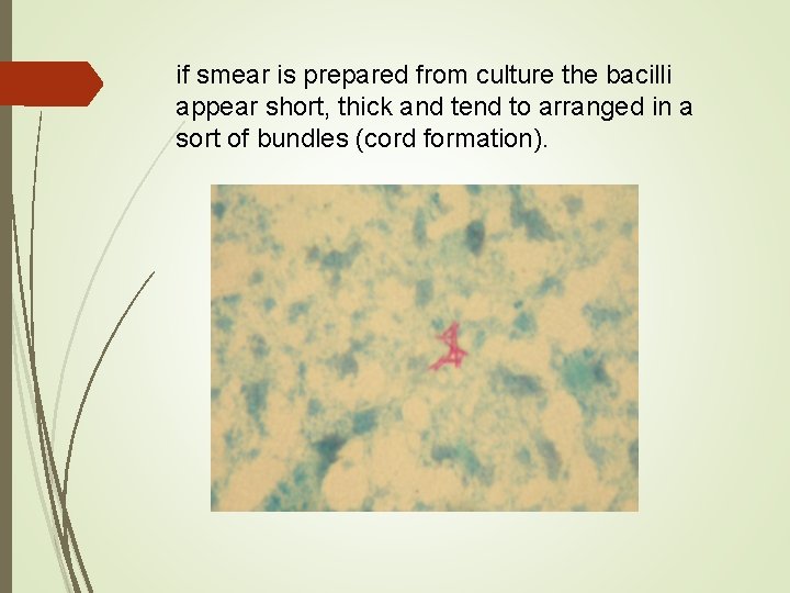 if smear is prepared from culture the bacilli appear short, thick and tend to
